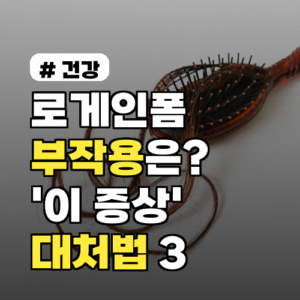 로게인폼 부작용, ‘이 증상’ 나타난다면? 대처법 3가지