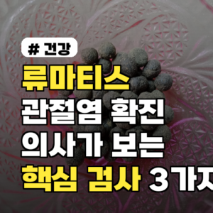 류마티스관절염 확진, 의사가 보는 핵심 검사 3가지