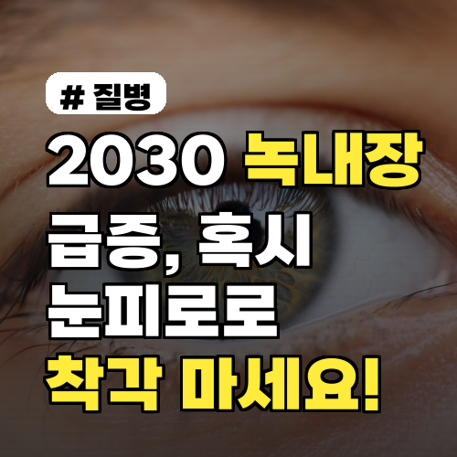 20대, 30대 녹내장 급증! 눈 피로 증상으로 착각 마세요