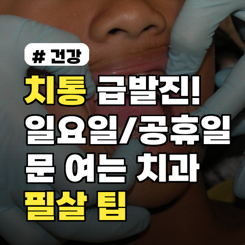 치통 급발진! 일요일/공휴일 문 여는 치과 찾는 필살 팁