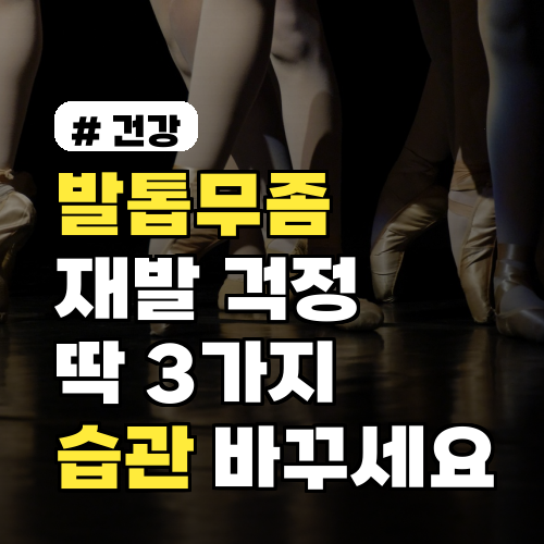 발톱무좀, 2026년 여름 재발 걱정 끝! 딱 3가지 습관 바꾸세요